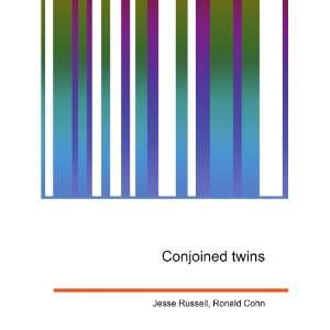 Conjoined twins Ronald Cohn Jesse Russell  Books