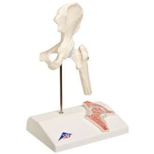 3B Scientific A84/1 Mini Hip Joint Model with Cross Section, 6.3 x 4 