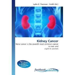 Kidney Cancer Renal cancer is the seventh most common cancer in men 