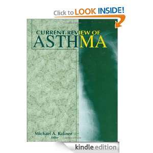 Current Review of Asthma Michael A. Kaliner  Kindle Store