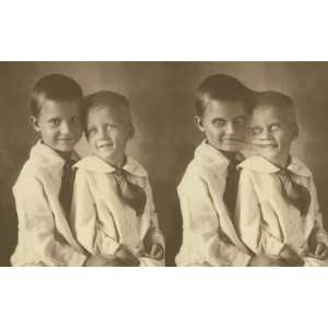 Conjoined Twins Changing Picture 8 x 10 
