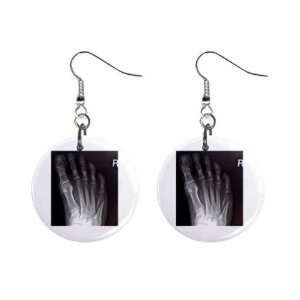 Foot X Ray 1 Round Button Dangle Earrings Jewelry
